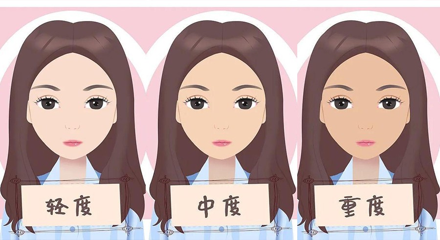 1647328541908033.jpg 2.jpg